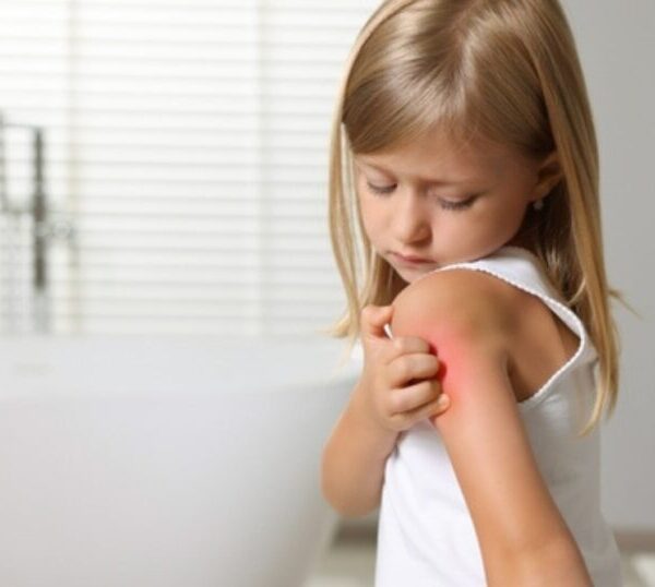 Εξανθήματα στο δέρμα των παιδιών