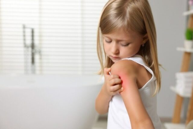 Εξανθήματα στο δέρμα των παιδιών