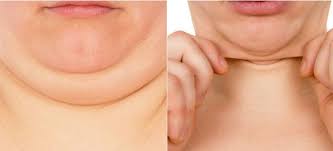 Χάσε λίπος στο πρόσωπό σου με αυτές τις 4 ασκήσεις προσώπου!